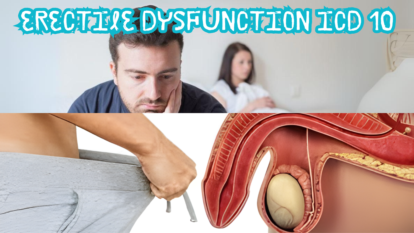 Erectile Dysfunction ICD 10